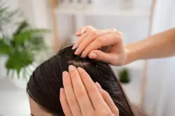 خلطات تساعدكِ للتخلص من القشرة و تعمل على تكثيف شعرك